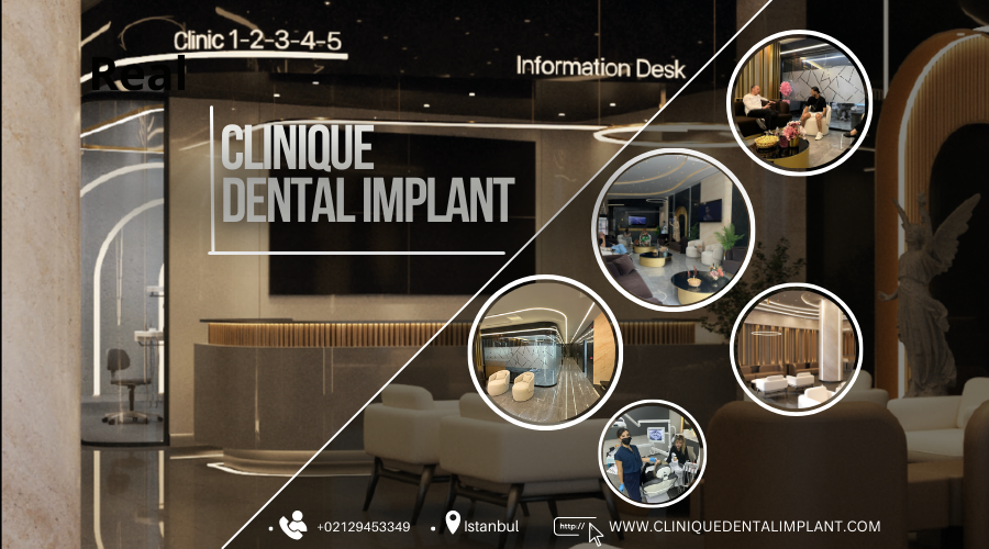 dental implants