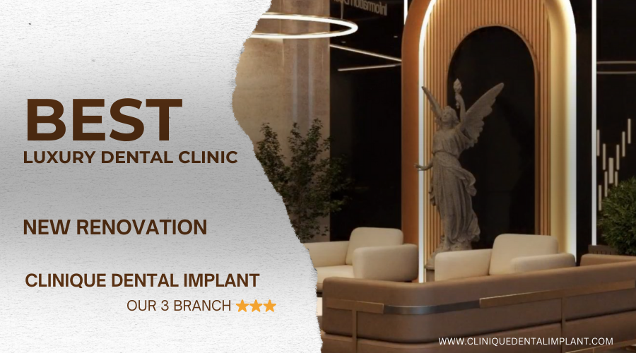 dental implants