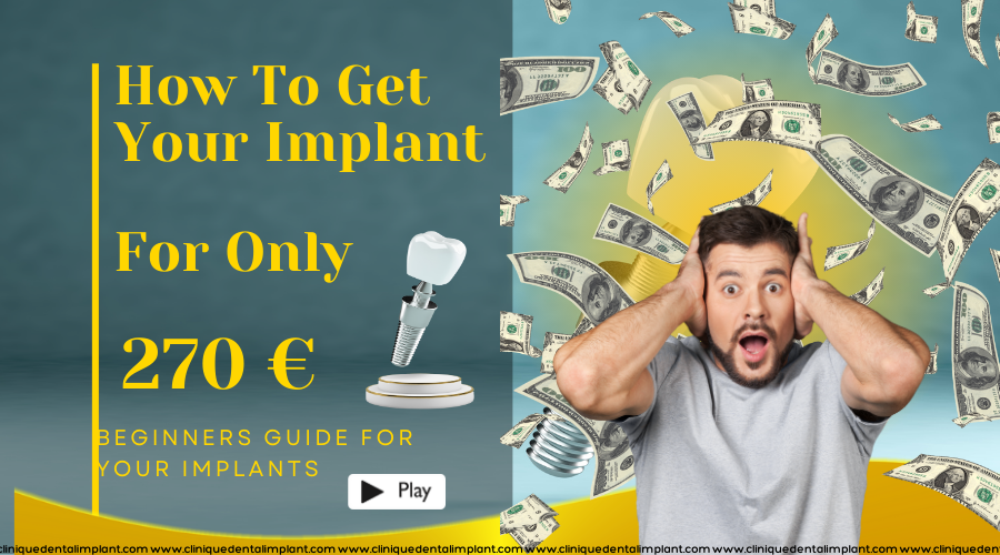 implant dentaire prix